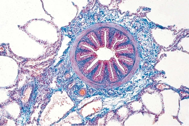 Histologické tričko pánské - plíce