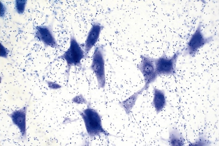 Histologické puzzle INFINITE - mozek