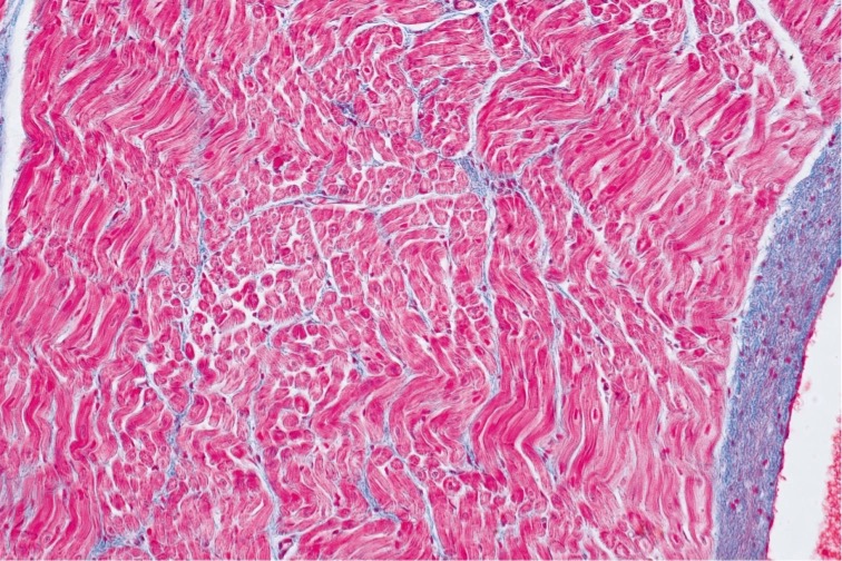 Histologické tričko pánské - srdce