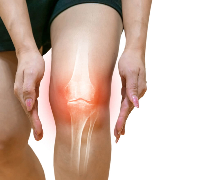 doplněk stravy pro zdravé klouby