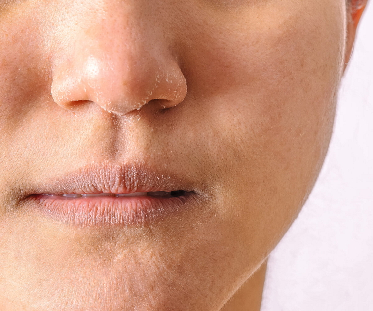 denní hydratační krém