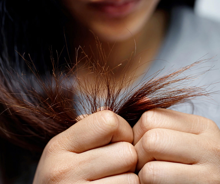 kyselina hyaluronová