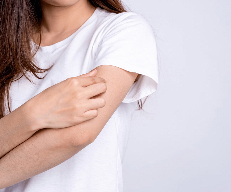 atopický ekzém ricinový olej venira