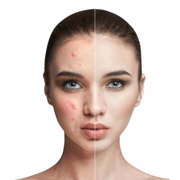 Phage Glow Bioactive gel