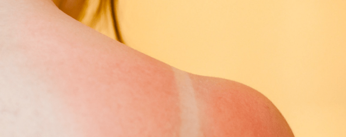 Ochrana před UV zářením