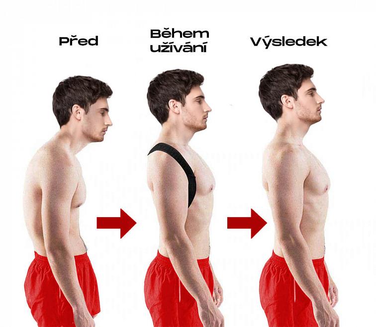 Korektor pro vzpřímené držení těla