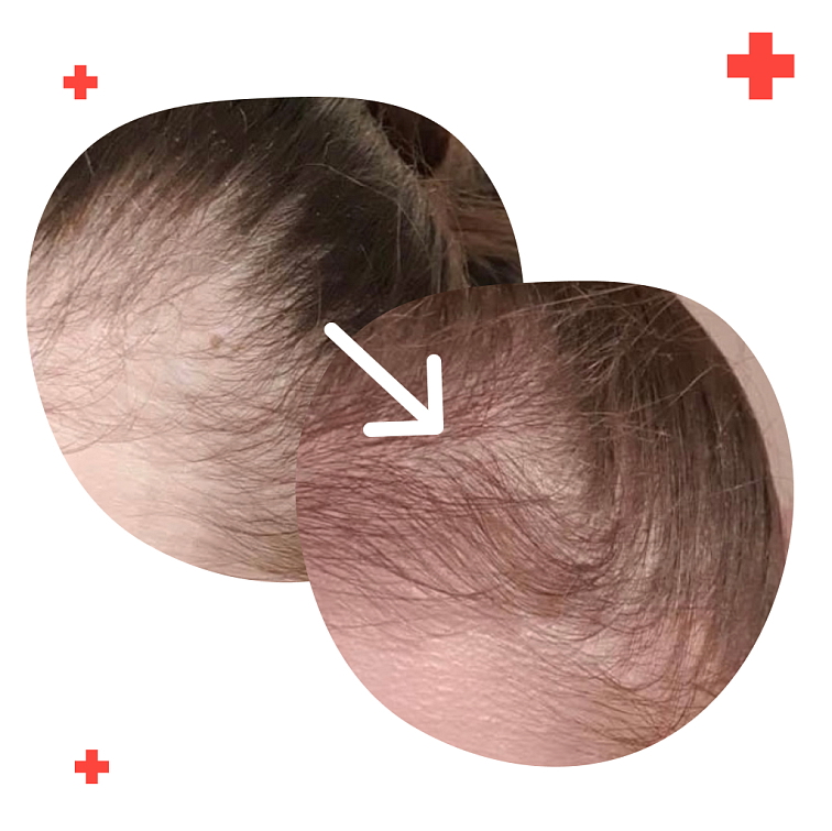 Renohair MAXIMAL 90 tablet