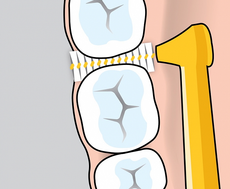 Curaprox 06 Prime Start Mezizubní Kartáček 5 ks