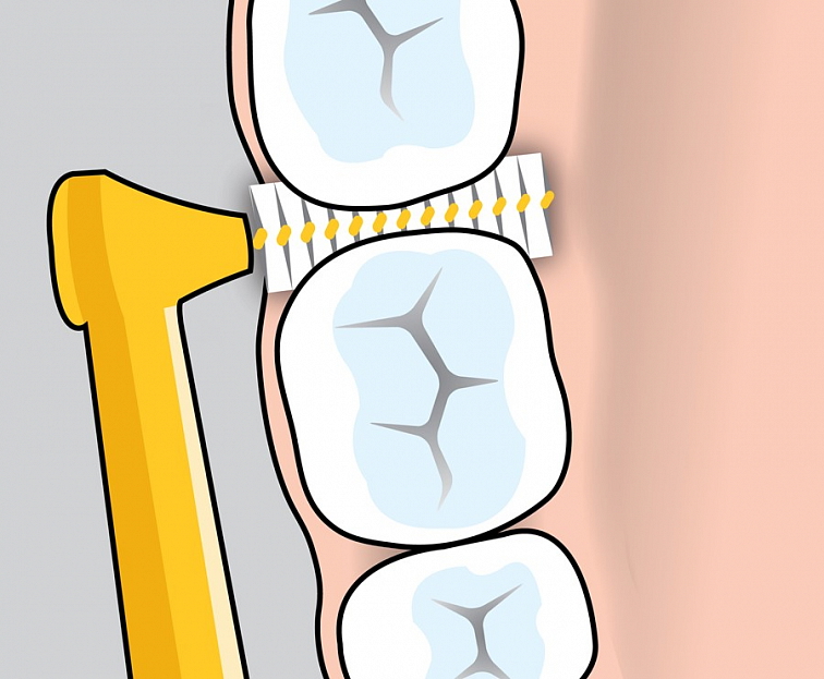 Curaprox 06 Prime Start Mezizubní Kartáček 5 ks