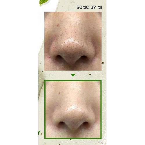 Some By Mi Super Matcha pore care Starter Kit - sada na zmenšení rozšířených pórů
