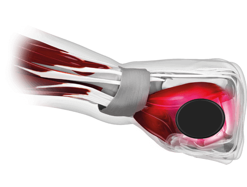 Bolest rukou a prstů, bezpečný úchop