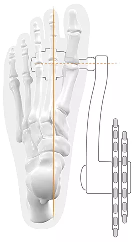 SQlab pedály 502 active