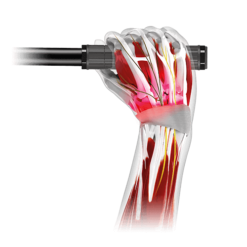 Bolest rukou a prstů, bezpečný úchop