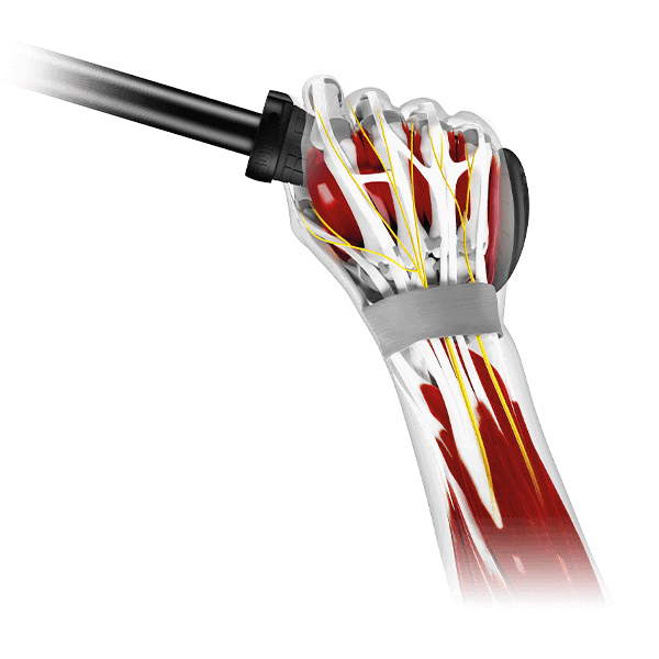 Bolest rukou a prstů, bezpečný úchop