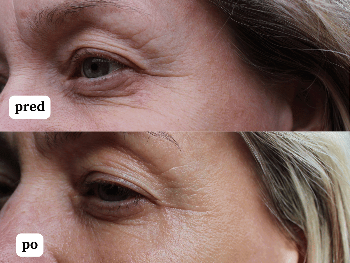 Vyhladzujúce sérum s peptidmi pre redukciu vrások