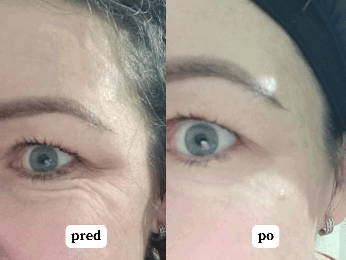 Vyhladzujúce sérum s peptidmi pre redukciu vrások