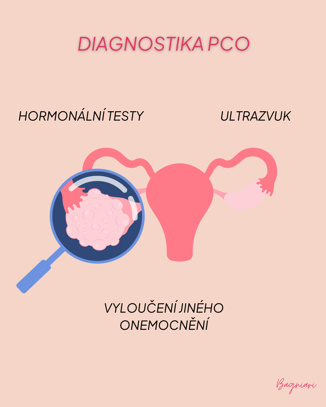 PCO – co to je: Polycystické vaječníky a jejich diagnostika