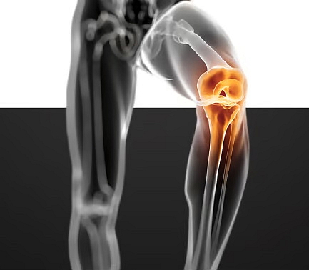 Nutrend Flexit Gold Drink 400 g