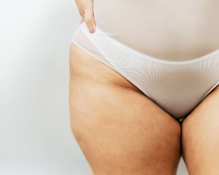 Náhradní náplň Krém proti celulitidě 200 ml + 20 ml GRATIS