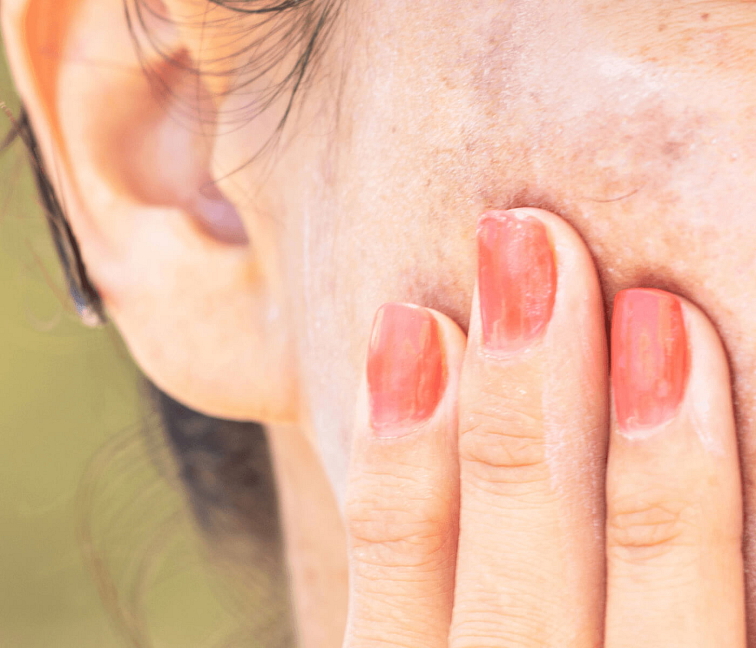 akné čistiací gél