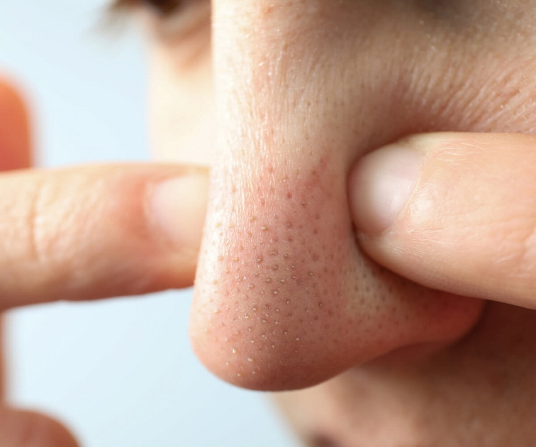 konjaková hubka na pleť