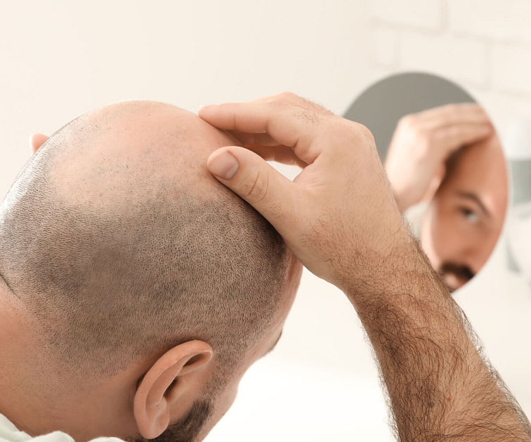 hair booster proti vypadavaniu vlasov u mužov