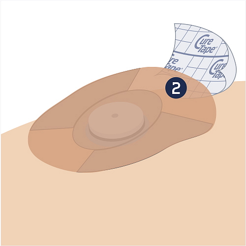 Ochranné náplasti na senzor MIX BAREV CureTape® 8 ks